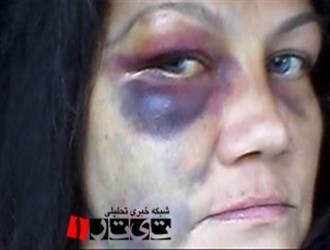 ضربه مشت بر صورت زنی باردار توسط پلیس آمریکا+تصاویر